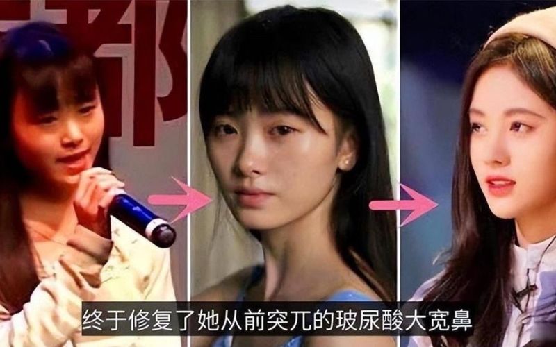 Những nữ diễn viên 'lên đời' nhờ chỉnh sửa nhan sắc thành công