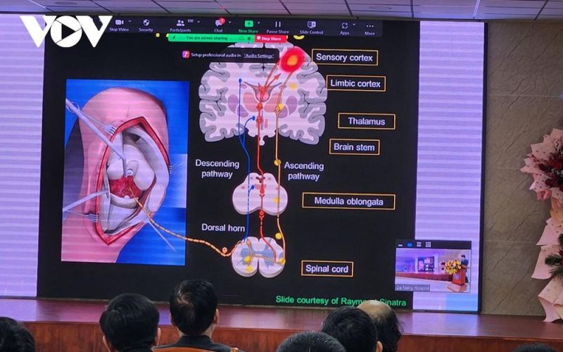 Ra mắt Đơn vị điều trị Đau, Bệnh viện Đà Nẵng